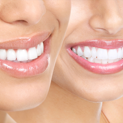 Sbiancamento denti LED: una tecnica efficace per un sorriso efficace!
